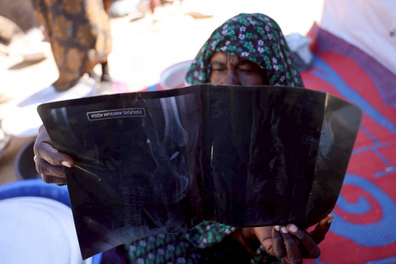 蘇丹戰火下生靈悲歌：怎麼選都是絕境